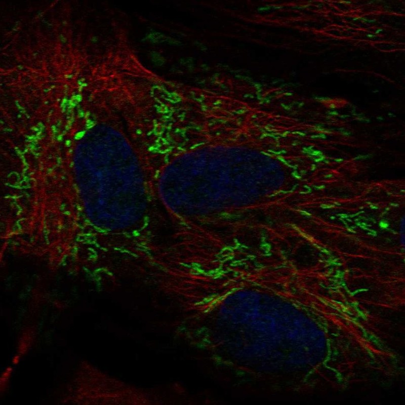 Atlas Antibodies Anti-ALDH1L2 Antibody