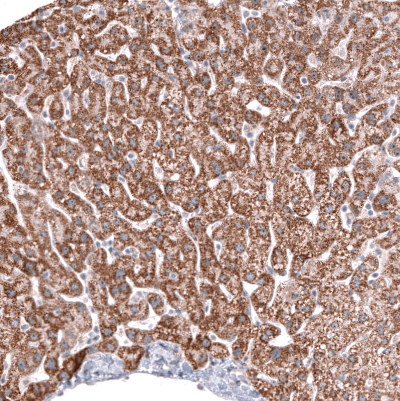 Atlas Antibodies Anti-ALDH2 Antibody