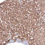 Atlas Antibodies Anti-ALDH2 Antibody