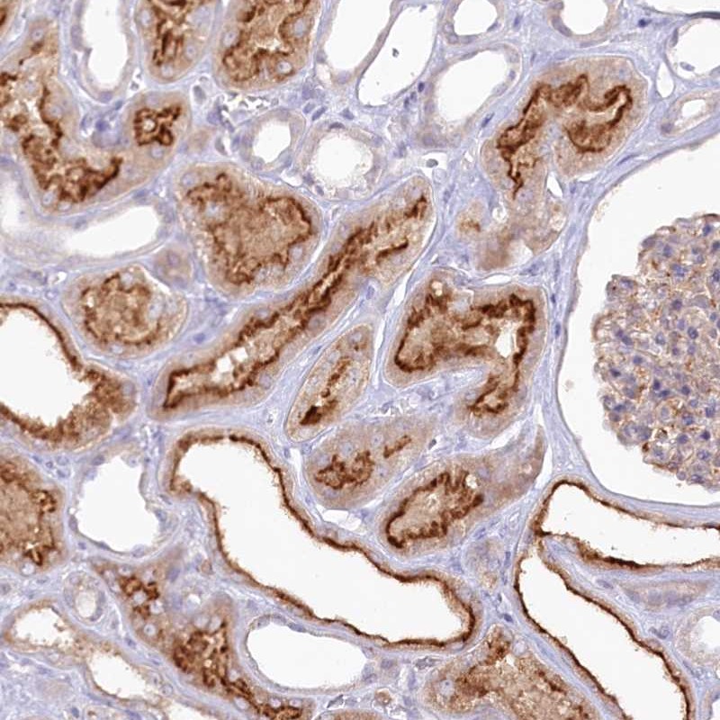 Atlas Antibodies Anti-ALDH3B1 Antibody
