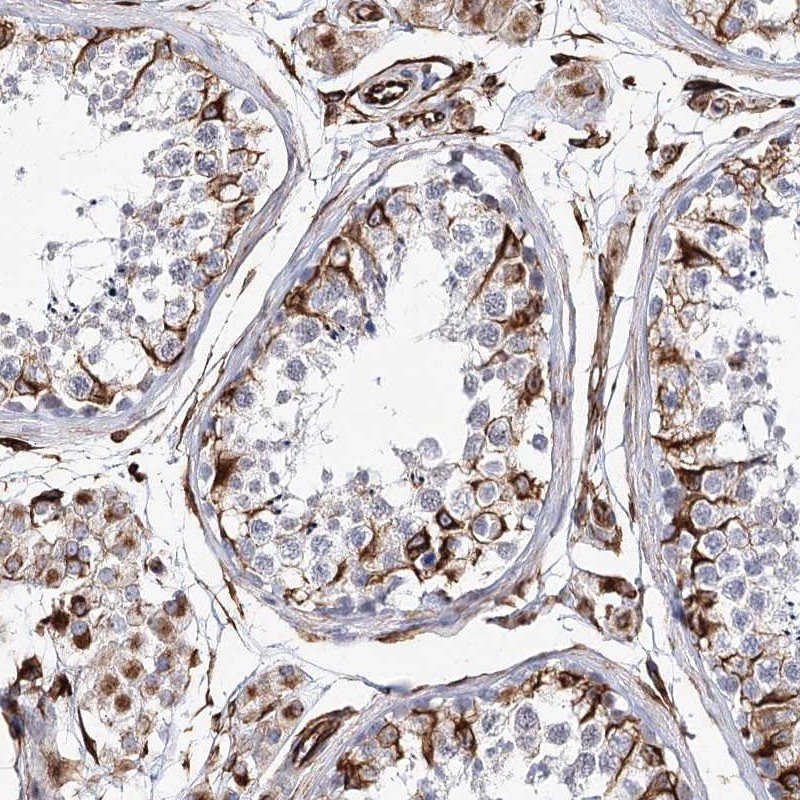 Atlas Antibodies Anti-ALG1L Antibody