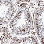 Atlas Antibodies Anti-ALG1L Antibody