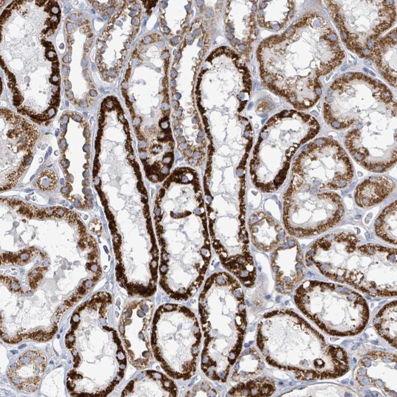 Atlas Antibodies Anti-ALG12 Antibody