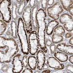 Atlas Antibodies Anti-ALG12 Antibody