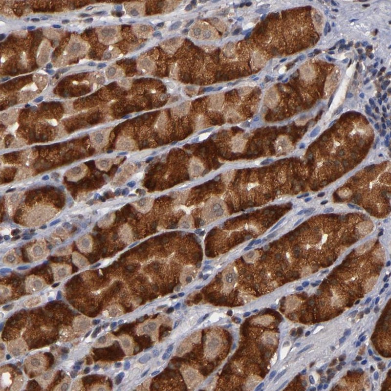 Atlas Antibodies Anti-ALG13 Antibody