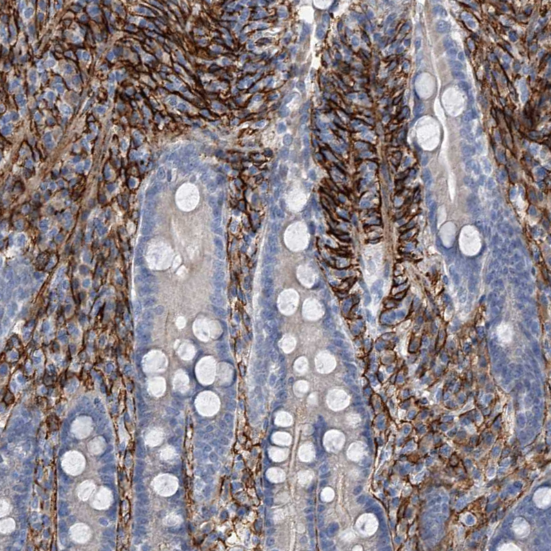 Atlas Antibodies Anti-ALG14 Antibody