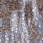 Atlas Antibodies Anti-ALG14 Antibody