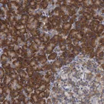 Atlas Antibodies Anti-ALG2 Antibody