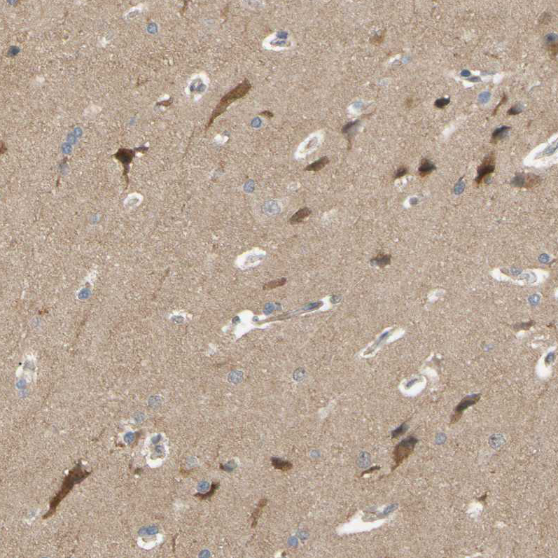 Atlas Antibodies Anti-ALK Antibody