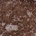 Atlas Antibodies Anti-ALG9 Antibody