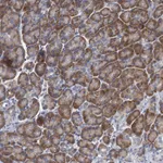 Atlas Antibodies Anti-ALG2 Antibody
