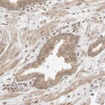 Atlas Antibodies Anti-ALKAL1 Antibody