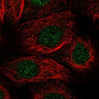 Atlas Antibodies Anti-ALKBH1 Antibody