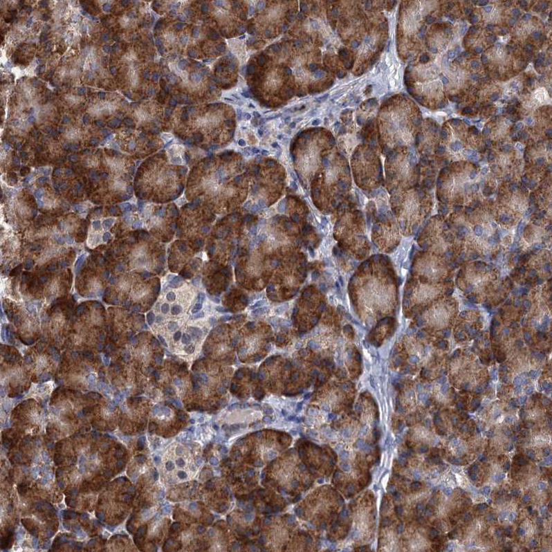 Atlas Antibodies Anti-ALKBH7 Antibody