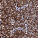 Atlas Antibodies Anti-ALKBH7 Antibody
