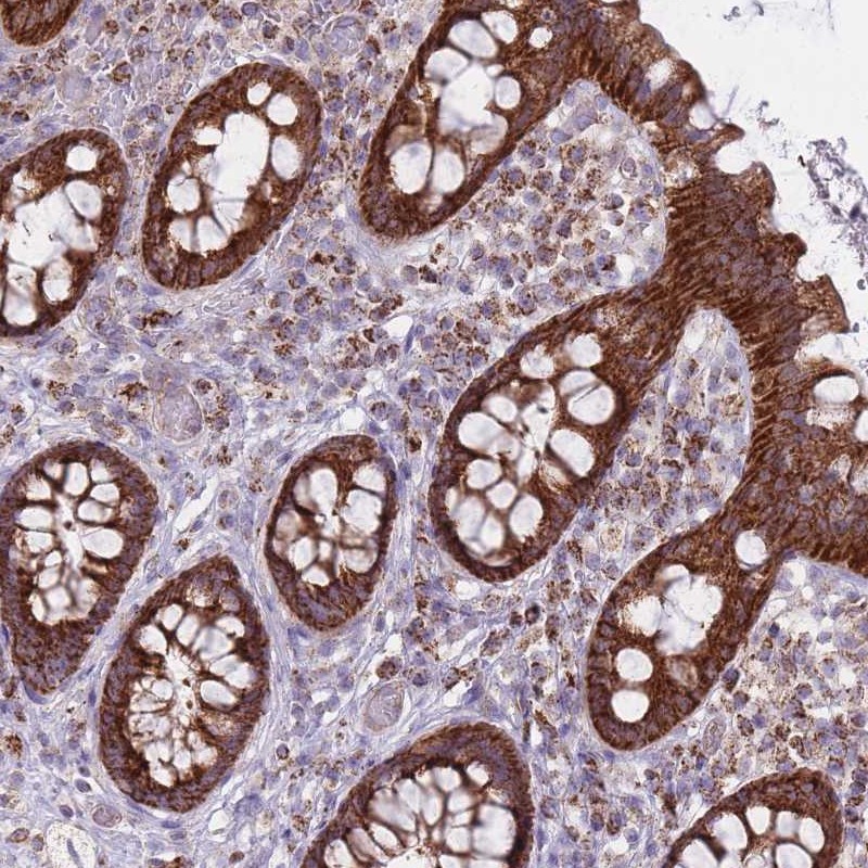 Atlas Antibodies Anti-ALKBH4 Antibody