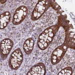 Atlas Antibodies Anti-ALKBH4 Antibody
