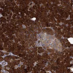 Atlas Antibodies Anti-ALKBH7 Antibody