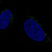 Atlas Antibodies Anti-ALKBH7 Antibody