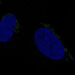 Atlas Antibodies Anti-ALKBH7 Antibody