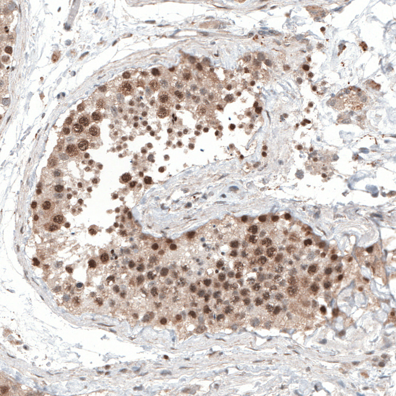 Atlas Antibodies Anti-ALKBH5 Antibody