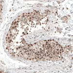 Atlas Antibodies Anti-ALKBH5 Antibody