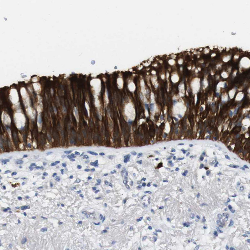 Atlas Antibodies Anti-ALOX15 Antibody