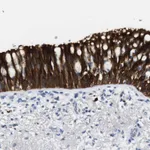 Atlas Antibodies Anti-ALOX15 Antibody