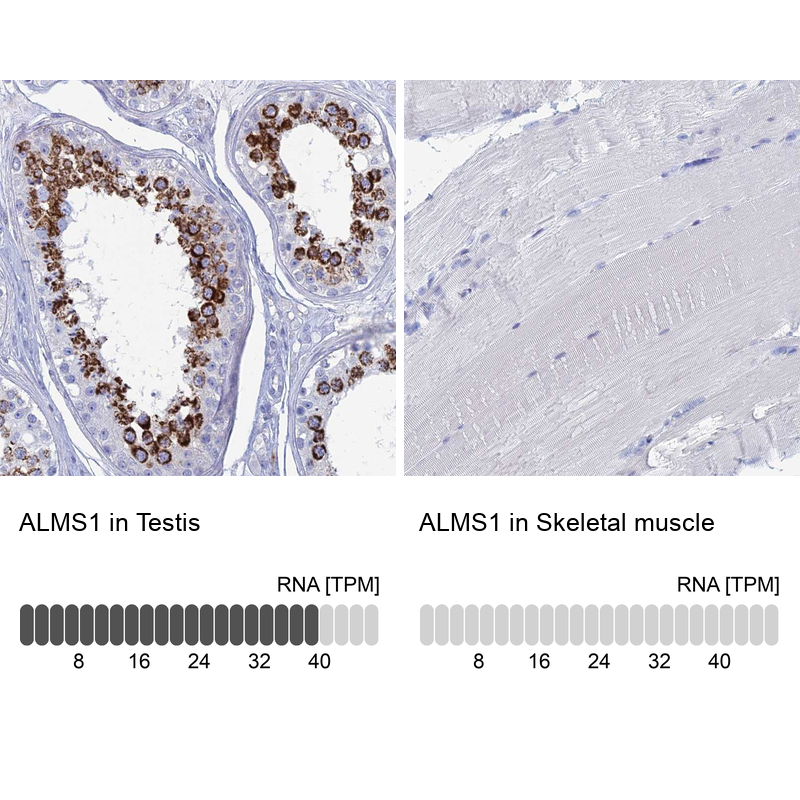 Atlas Antibodies Anti-ALMS1 Antibody