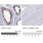 Atlas Antibodies Anti-ALMS1 Antibody
