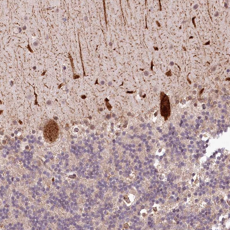 Atlas Antibodies Anti-ALKBH8 Antibody