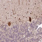 Atlas Antibodies Anti-ALKBH8 Antibody