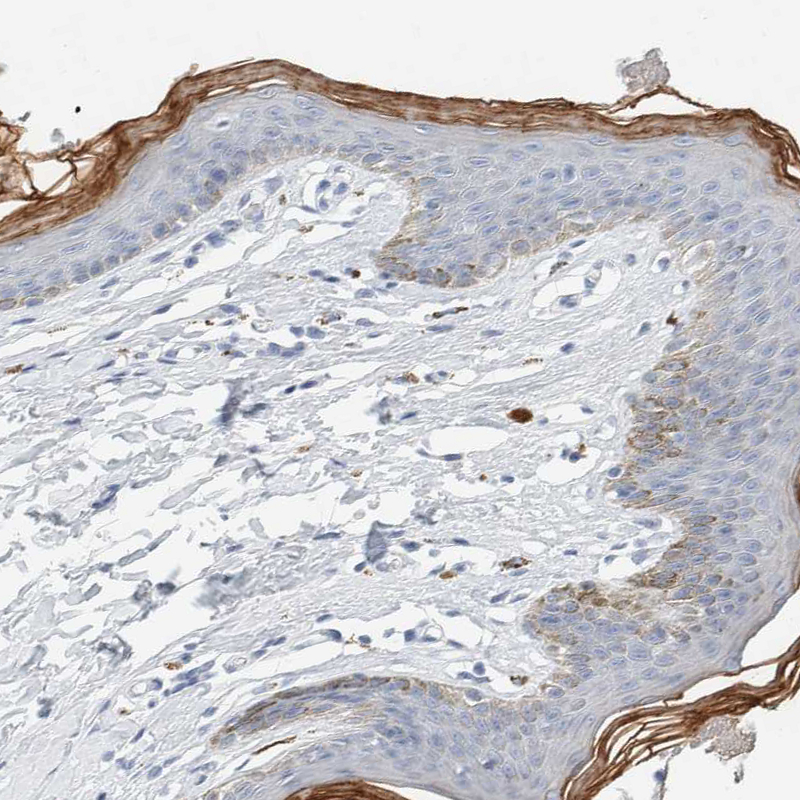 Atlas Antibodies Anti-ALOX12B Antibody