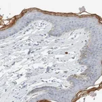Atlas Antibodies Anti-ALOX12B Antibody