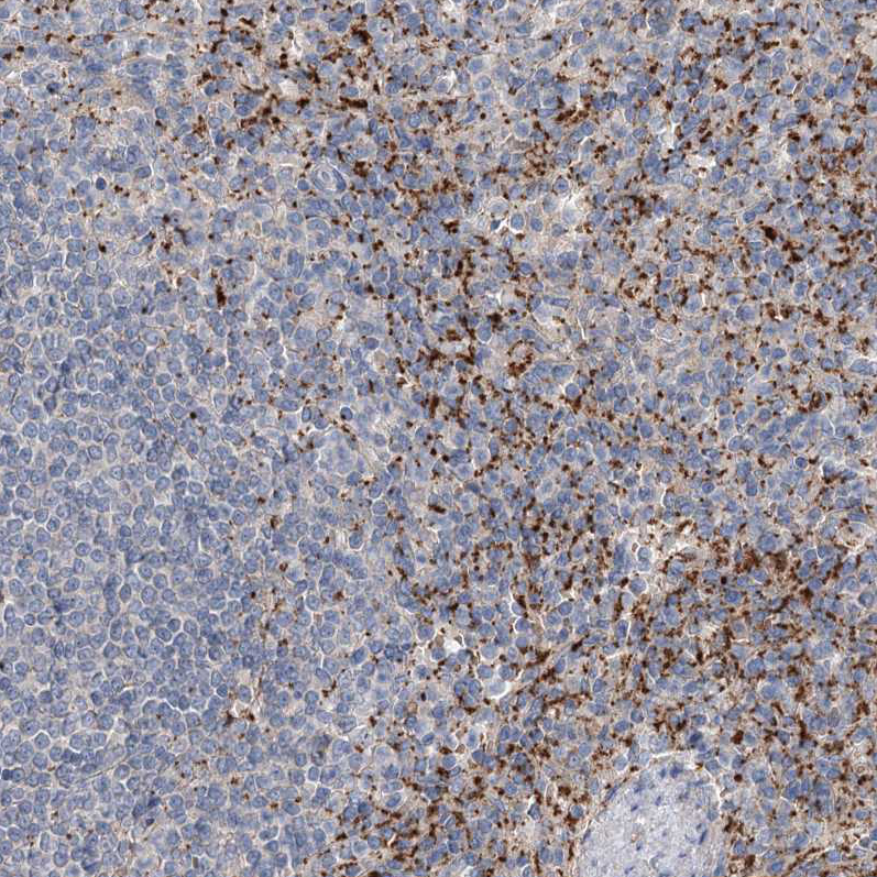 Atlas Antibodies Anti-ALKBH8 Antibody