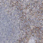 Atlas Antibodies Anti-ALKBH8 Antibody