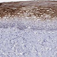 Atlas Antibodies Anti-ALOX12 Antibody