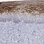 Atlas Antibodies Anti-ALOX12 Antibody