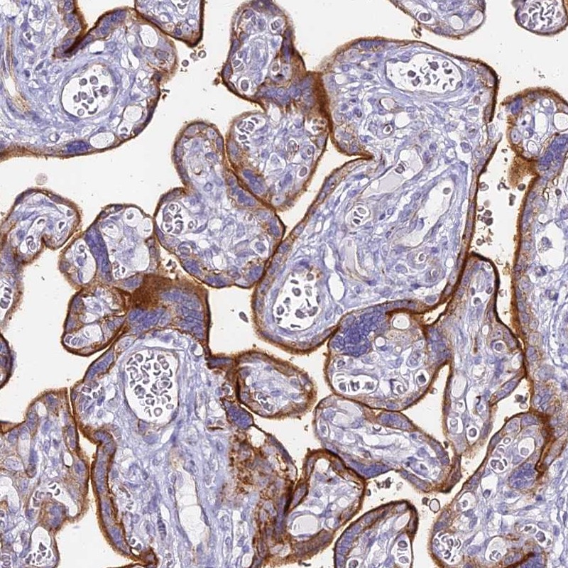 Atlas Antibodies Anti-ALPI Antibody