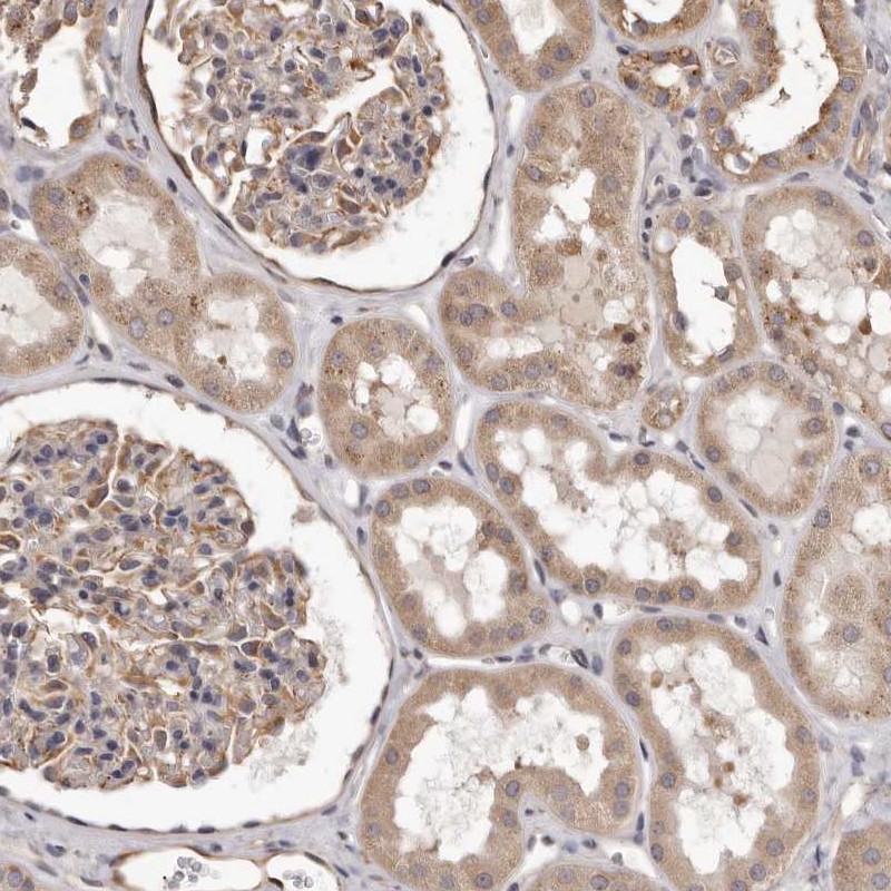 Atlas Antibodies Anti-ALPK1 Antibody