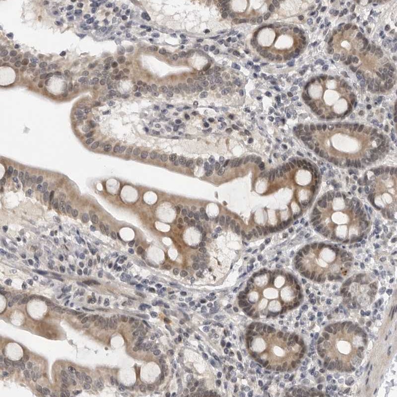 Atlas Antibodies Anti-ALPK2 Antibody