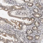 Atlas Antibodies Anti-ALPK2 Antibody