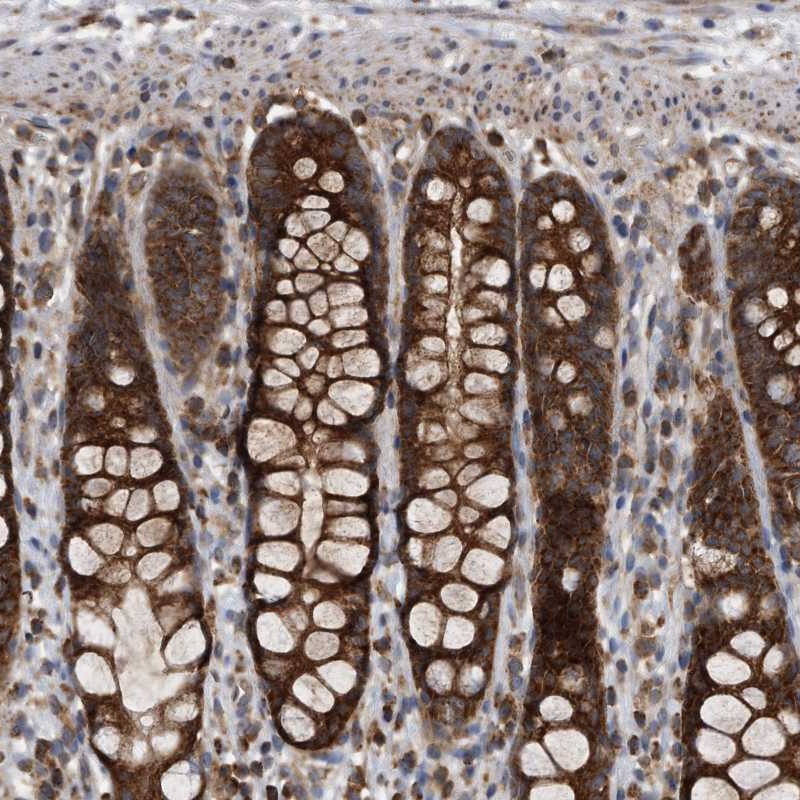 Atlas Antibodies Anti-ALPK2 Antibody