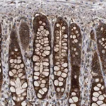 Atlas Antibodies Anti-ALPK2 Antibody