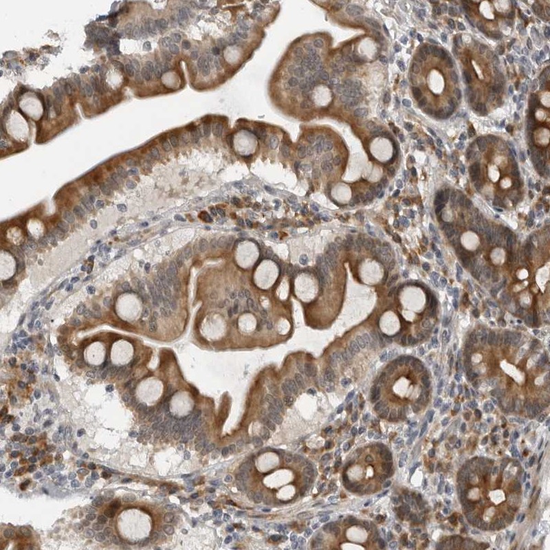 Atlas Antibodies Anti-ALPK2 Antibody