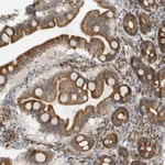 Atlas Antibodies Anti-ALPK2 Antibody