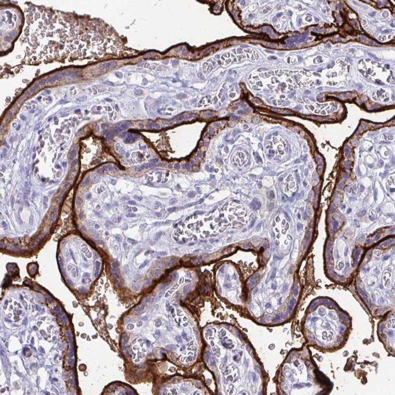 Atlas Antibodies Anti-ALPI Antibody