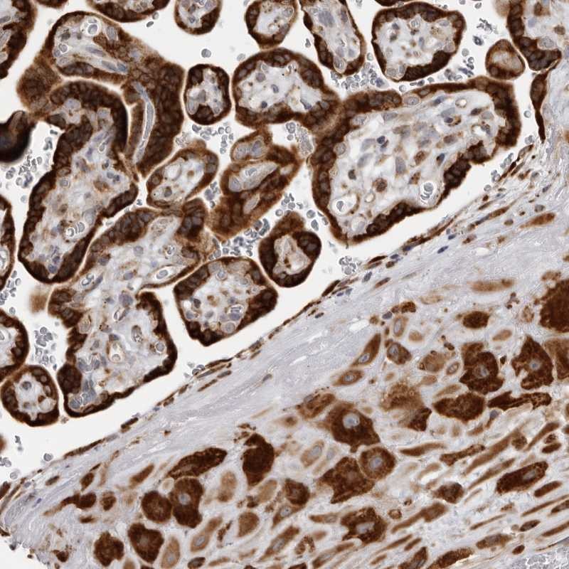 Atlas Antibodies Anti-ALPK2 Antibody