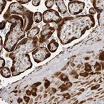 Atlas Antibodies Anti-ALPK2 Antibody