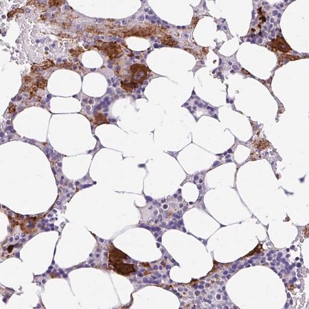 Merck Anti-ESPNL antibody produced in rabbit